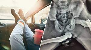 Check spelling or type a new query. Akibat Letak Kaki Di Dashboard Kereta Pinggang Wanita Ini Hancur 100 Cerita Terkini Sensasi Dan Tepat