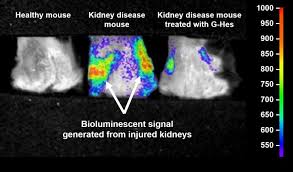 Rare medical conditions may not be included below. Genetically Modified Mice Can Show Which Functional Foods Can Heal Kidney Disease Eurekalert Science News
