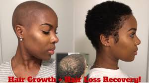 Check out these adorable ideas for monthly pictures that you'll love looking back on, but that aren't too high maintenance so baby will still cooperate and even have fun! 4 Month Update Hair Regrowth After Hair Loss Current Hair Care Routine Growwithme Nia Hope Youtube