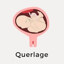 Bis wann dreht sich ein baby? Kindslage Wie Liegt Das Baby Im Bauch Hallo Eltern