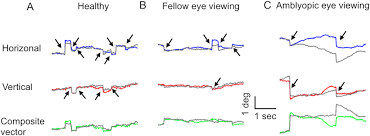 Image result for Visual Fixation