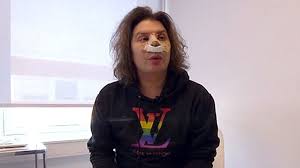 Bjørn langsem / dagbladet vis mer. Erlend Elias 35 Hyret Healer Fordi Han Skulle Operere Nesa