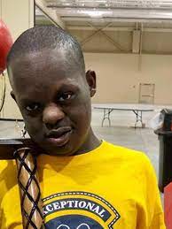 Down syndrome is a genetic disorder that causes physical problems and intellectual disabilities. Police Seek Suspects In Home Invasion Shooting Of Teen With Down Syndrome And Dog Wciv