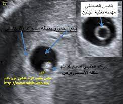 الجنين في الاسبوع السادس