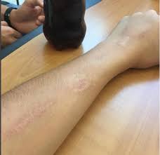 Aftermath salt and ice challenge. Wtf Kids Is There A Stupid Social Media Challenge You Won T Try