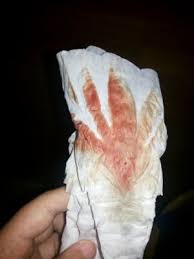Sangrado De Implantacion Buscando Bebe Babycenter