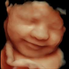 Gifts From Above 4D Ultrasound