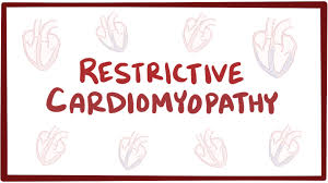 Image result for Restrictive Cardiomyopathy