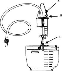 Prevention Of Nosocomial Urinary Tract Infection In Icu Patients Chest