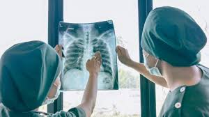 Image result for Chest Trauma