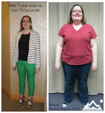 Pin On Wls Patient Stories