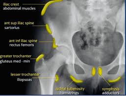 Image result for Hip Apophysitis