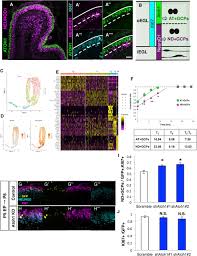 After effects expressions for beginners introduction: Cyclind1 Controls Development Of Cerebellar Granule Cell Progenitors Through Phosphorylation And Stabilization Of Atoh1 Biorxiv
