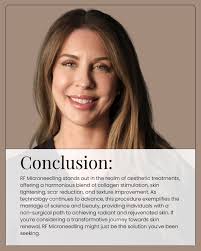 Unveiling the Beauty Beneath with Virtue RF Microneedling by Danielle  LeBlond LE-CLT This advanced treatment combines microneedling with  radiofrequency energy to smooth, tighten, and rejuvenate your skin, all  with minimal downtime. From