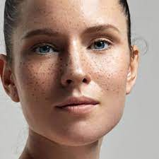 Respring any iphone, ipad, or ipod touch! Apa Perbedaan Freckles Dan Flek Hitam Di Wajah Atau Muka
