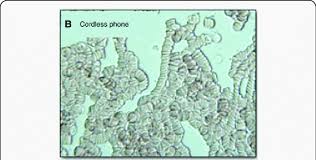 Clinical image of these red blood cells exposed to the dangers of ...