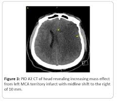 The advantages of brevity should be weighed against the possibilities of obfuscation (making the communication harder for others to understand) and ambiguity. Ligate To Live Stab Wound To The Neck With Major Vascular Injuries Insight Medical Publishing