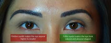 1 brow is fuller than the other and 1 eye lid is bigger than the other. Advanced Technique Making Uneven Eyes Look Symmetrical Dela Antoinette S