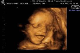 23 haftalık gebelikte bebeğin boyu ve kilosu merak edilen bu soruyu yanıtlayacağız. 27 Haftalik Gebelik Bebek Kilosu Boyu Gelisimi Goruntusu Mavi Kadin