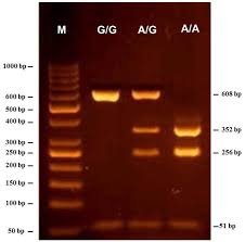 The analysis included total solids, fat, protein, vitamins, minerals, and organic acids. Aab Association Of B Casein Gene Polymorphism With Milk Composition Traits Of Egyptian Maghrebi Camels Camelus Dromedarius