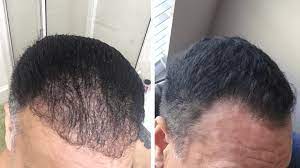 Memang, apa saja manfaat aloe vera untuk rambut? Ketahui 8 Manfaat Lidah Buaya Untuk Rambut Dan Cara Menggunakannya Gak Perlu Perawatan Mahal Lho