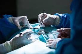 La vasectomía o deferentectomía consiste en la sección y ligadura de los conductos deferentes. Cirurgia De Vasectomia Saiba O Que E E Como Funciona
