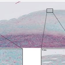 21 desember natal ama ina hkbp tanjung sari medan : Pdf Systematic Review And Meta Analysis Extreme Diversity Of The Human Vascular Mesenchymal Cell Landscape