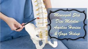 Allow staff to request for time off and swap shifts. Cara Mencegah Slip Disc Yang Boleh Dilakukan Ohcantik Com