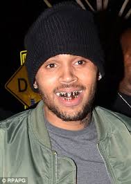 Juvenile and b.g.'s tha block is hot. Grillz Why Are Madonna Rihanna And Miley Cyrus Sinking Their Teeth Into The Bizarre Mouth Bling Daily Mail Online