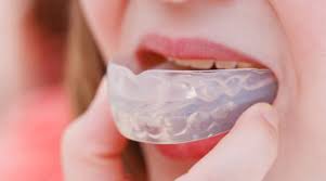 How to shape a mouthguard? Use A Mouthguard To Protect Your Teeth Fisher Pointe Dental