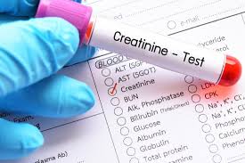 creatinine blood test purpose procedure and low or high