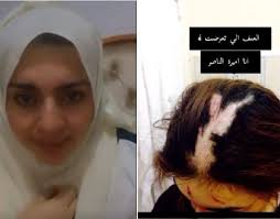 العناكب بدات الهجوم على سكان استراليا ومو اي نوع انما اقوى العناكب بالعالم و اخطرهاجميع حساباتي في. Ù…Ø´Ù‡ÙˆØ±Ø© Ø³Ù†Ø§Ø¨ Ø´Ø§Øª Ø£Ù…ÙŠØ±Ø© Ø§Ù„Ù†Ø§ØµØ± ØªØ®Ù„Ø¹ Ø§Ù„Ø­Ø¬Ø§Ø¨ ÙˆØªÙƒØ´Ù Ø£Ø«Ø§Ø± Ø¶Ø±Ø¨ Ù…Ø¨Ø± Ø­ Ø¹Ù„Ù‰ Ø¬Ø³Ø¯Ù‡Ø§