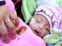 10listings 20.143 views4 years ago. World S Smallest And Youngest Preemies