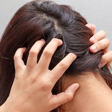However, due to various factors such as dirt, stress, anxiety, dandruff issues, and others, things can get out of hand. Some Not To Miss Scalp Infections Which Causes Hair Loss Ahs India