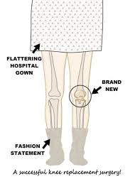 Get Well Knee Replacement Surgery Patient With New Knee Card Ad Sponsored Replacement Knee S Knee Replacement Surgery Knee Replacement Stamped Cards