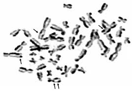 A full set of sister chromatids is created during the synthesis (s) phase of interphase,. Sister Chromatid Exchange A Possible Approach To Characterize Familial Breast Cancer Patients