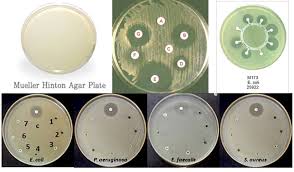 Mueller Hinton Agar Mha Composition Principle Uses And