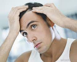 The hair loss may be heavier at first, and then gradually slow or stop. Why Do Men Go Bald With Pictures