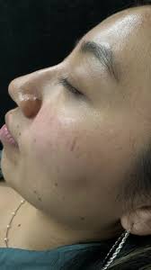 Armonización Orofacial Dra Luisa Ruiz Saltillo