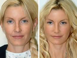How do you polish your image so you can most effectively show off the —never, ever, wear pleats—for godssakes. Japanese Beauty Secret To Look 10 Years Younger In Just 7 Days