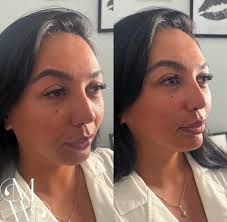 Monique Whitehurst-FNP, Aesthetic Injector/Trainer💉  (@nurseinjectormo__fnp) · Instagram 照片和视频