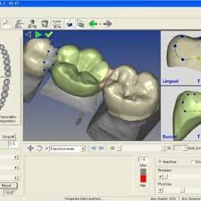 Innovative Cad Cam Technology Download Scientific Diagram