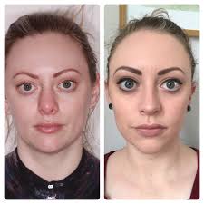 Charles East (@rhinoplastyking)