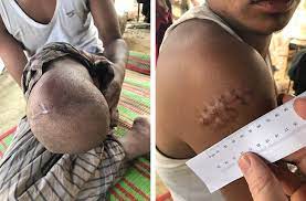 Horrified, mason responded, my god, you're here for that reason? following his arrest, mason was further identified by the bullet graze wound scar on his back, from a bullet fired by officer phillips in 1957. Please Tell The World What They Have Done To Us Physicians For Human Rights
