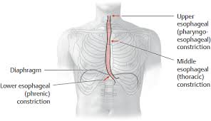 One Year Of Abdominal Pain Gone After One Ultrasound-Guided Cortisone  Injection