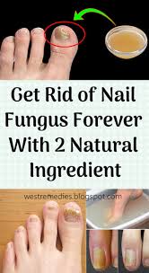 Combine equal quantity of acv and water. Get Rid Of Nail Fungus Forever With 2 Natural Ingredient Fise Jointeria