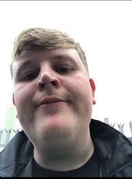 Gastric Sleeve Before and After in Men