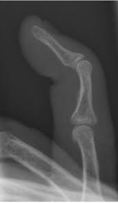 J hand surg eur vol. X Hand Startradiology