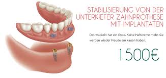 Zahnarzt Slowenien Artident Ljubljana Stabilisierung Von Der Unterkiefer Zahnprothese Mit Implantaten Kontakt Info Zahnarztslowenien At Facebook
