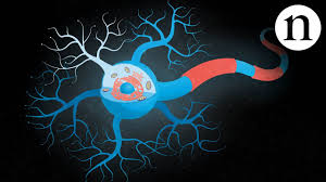 Amyotrophic lateral sclerosis (als), sometimes called lou gehrig's disease, is a progressive neurological disease that attacks the nerve cells (neurons). Inside Als The Neurons Behind The Disease Youtube